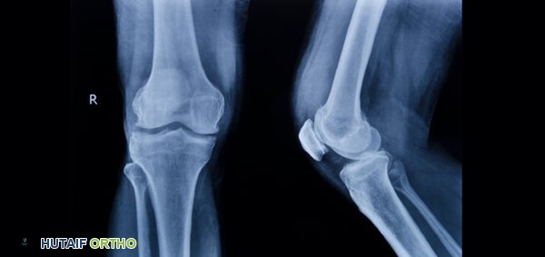 صورة توضيحية لـ تشريح القدم: دليل شامل لفهم بنية قدميك وصحتها مع الأستاذ الدكتور محمد هطيف