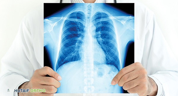 What You Need to Know About RA and Lung Disease