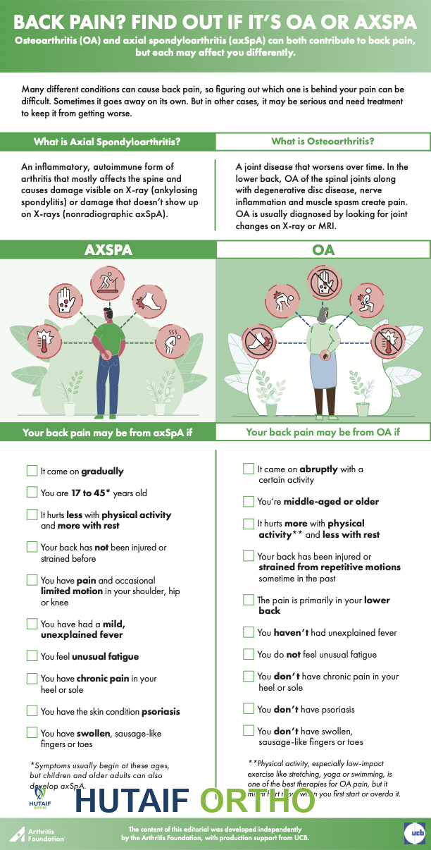 هل تعاني من آلام الظهر؟ اكتشف الفرق بين الفصال العظمي والتهاب الفقار اللاصق المحوري مع الأستاذ الدكتور محمد هطيف