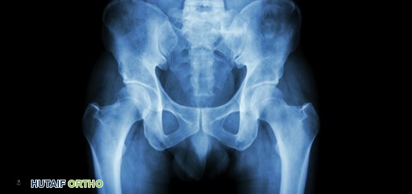 تشريح المرفق ووظائفه: دليل شامل لصحة مفصل الكوع مع الأستاذ الدكتور محمد هطيف