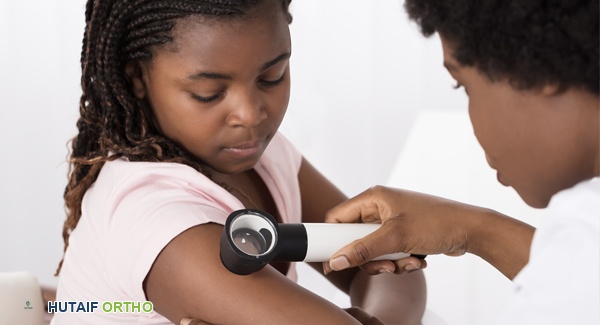 طفل يعاني من التهاب المفاصل الروماتويدي الشبابي الجهازي