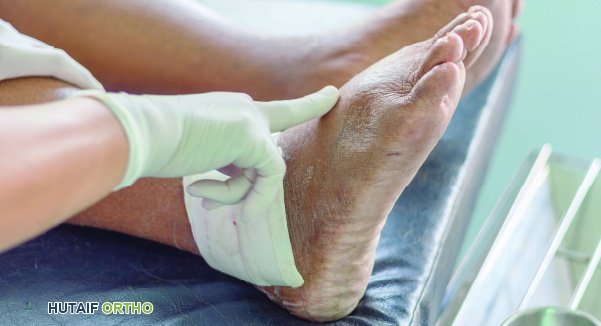 صورة توضيحية لـ النقرس ليس مزحة: دليل شامل للمرضى مع الأستاذ الدكتور محمد هطيف في صنعاء