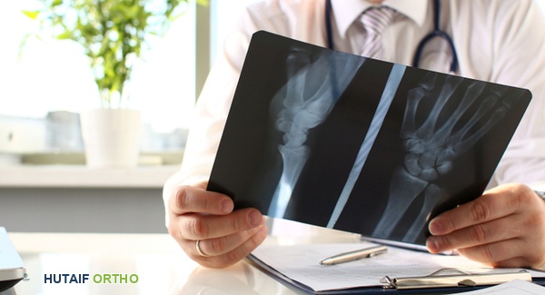 التصوير التشخيصي للالتهاب المفصلي الروماتويدي: دليل شامل من الأستاذ الدكتور محمد هطيف في صنعاء