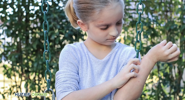 طفل مصاب بالتهاب الجلد والعضلات اليافع