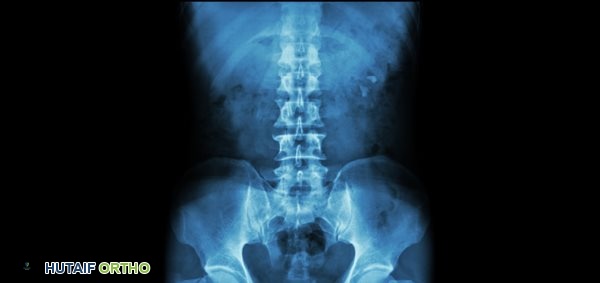 Anatomy of the Spine Upper Back, Lower Back and Neck