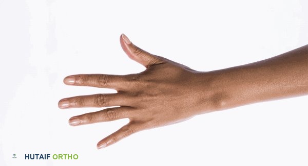 صورة توضيحية لـ خشونة مفاصل اليدين: دليل شامل للتشخيص والعلاج والتعافي مع الأستاذ الدكتور محمد هطيف
