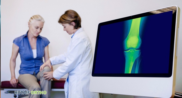 صورة توضيحية لـ العلاج بالبرولورثيرابي لالتهاب المفاصل العظمي دليل شامل من الأستاذ الدكتور محمد هطيف