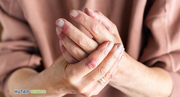 التهاب المفاصل الصدفي: دليل شامل لإدارة الأمراض المصاحبة والعلاج المتكامل مع الأستاذ الدكتور محمد هطيف