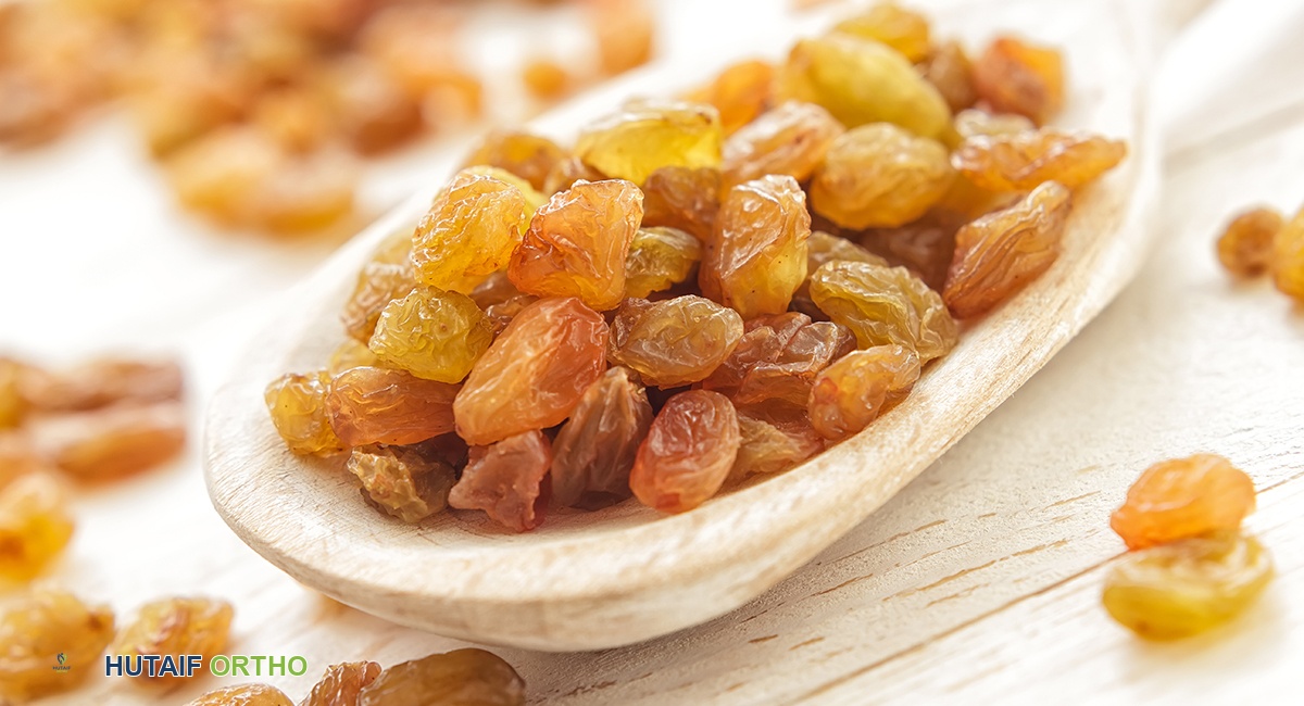 إدارة التهاب المفاصل الشاملة: من التشخيص إلى التغذية العلاجية مع الأستاذ الدكتور محمد هطيف في صنعاء