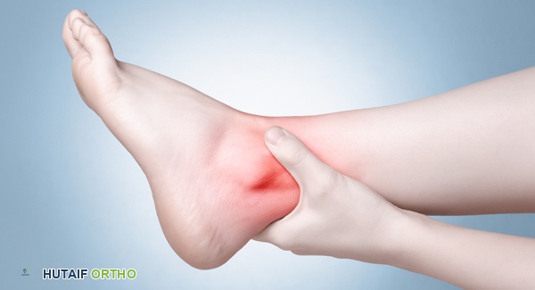 صورة توضيحية لـ خيارات جراحة التهاب مفصل الرسغ: دليل شامل للمرضى في صنعاء مع الأستاذ الدكتور محمد هطيف