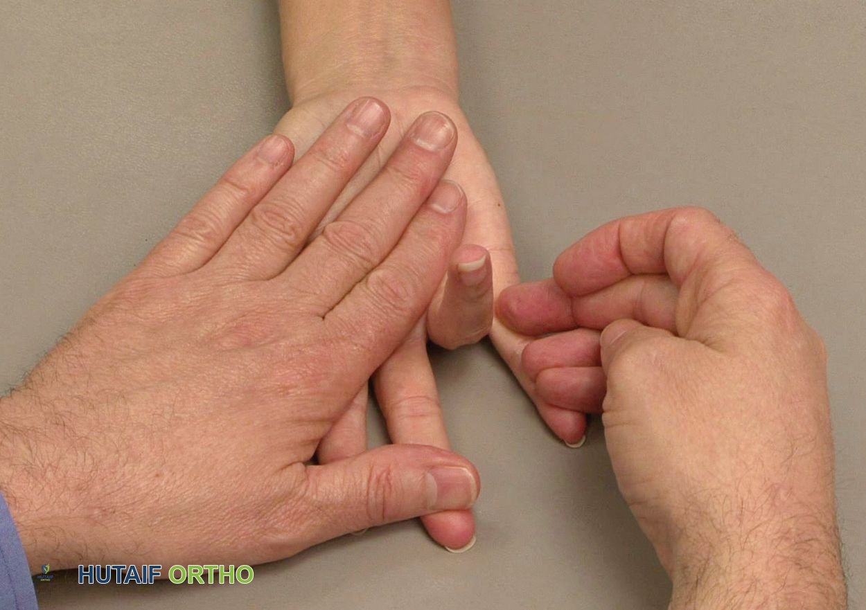 صورة توضيحية لـ الإصبع الزنادي: الدليل الشامل لأسباب الأعراض والعلاج مع الأستاذ الدكتور محمد هطيف في صنعاء