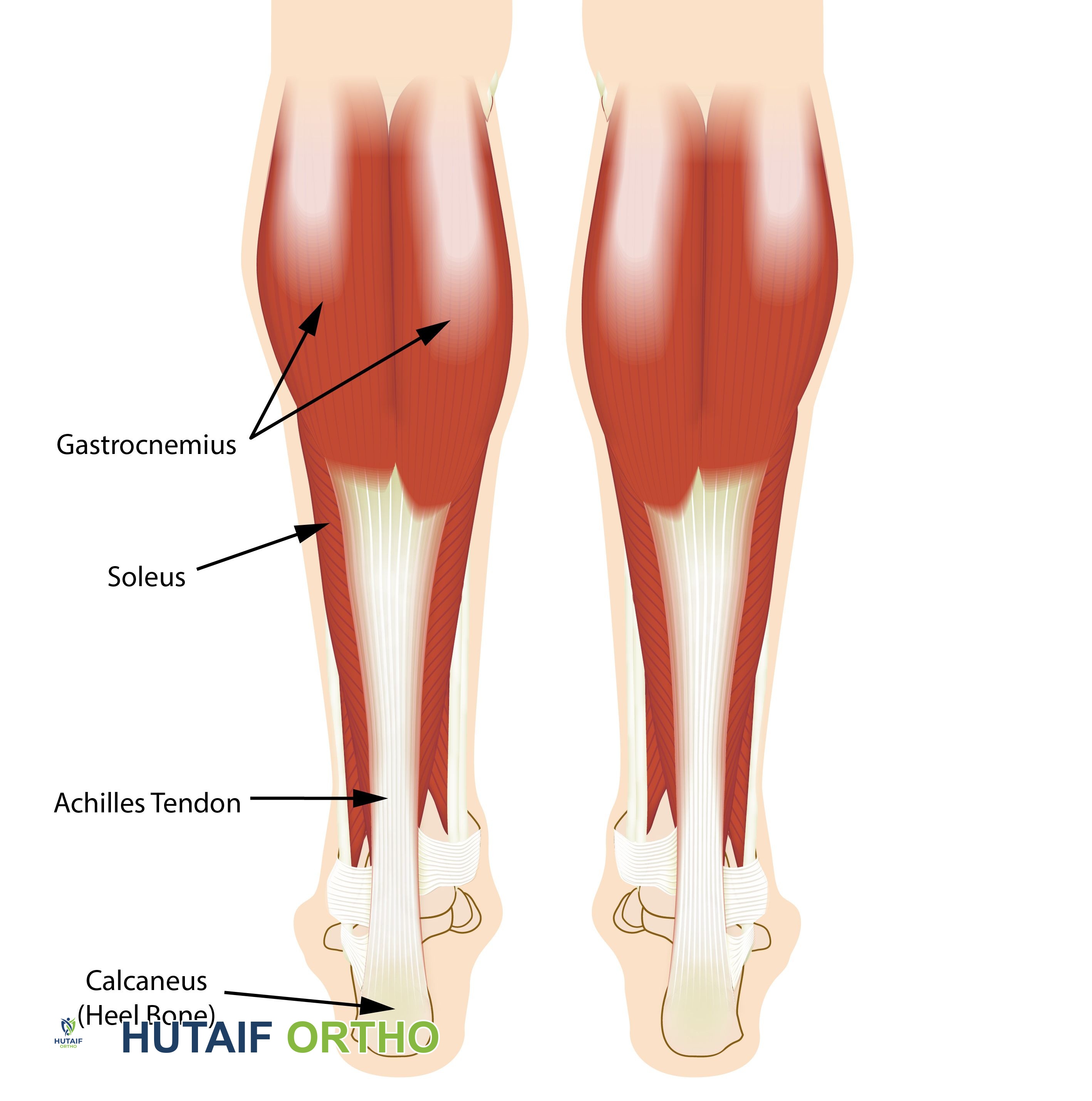 المشي على رؤوس الأصابع عند الأطفال: دليل شامل للآباء مع الأستاذ الدكتور محمد هطيف في صنعاء