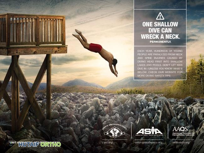 سلامة الغوص: دليلك الشامل لتجنب إصابات الرقبة والشلل