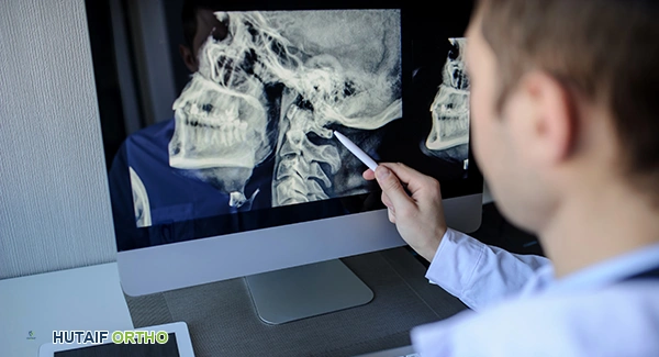 العلاجات المتقدمة لالتهاب المفاصل الروماتويدي في اليدين: دليل شامل من الأستاذ الدكتور محمد هطيف