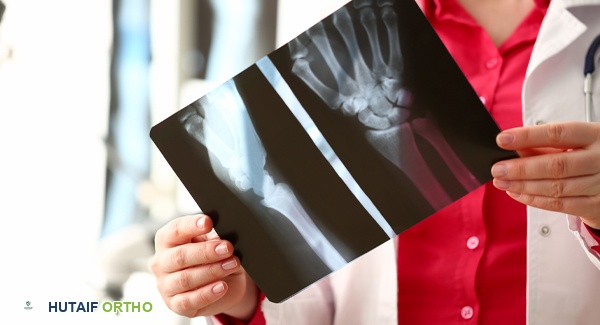 صورة توضيحية لـ علاجات خشونة المفاصل: دليل شامل لتخفيف الألم واستعادة الحركة مع الأستاذ الدكتور محمد هطيف