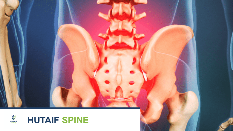 أعراض تمدد الشريان الأورطي البطني: دليل شامل للوقاية والتشخيص والعلاج مع الأستاذ الدكتور محمد هطيف
