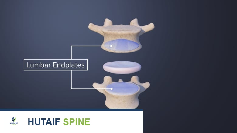 كي العصب القاعدي الفقري: حل مبتكر وفعال لآلام أسفل الظهر المزمنة