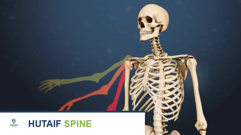 أعراض التهاب الضفيرة العضدية (متلازمة بارسوناغ-تيرنر): دليلك الشامل