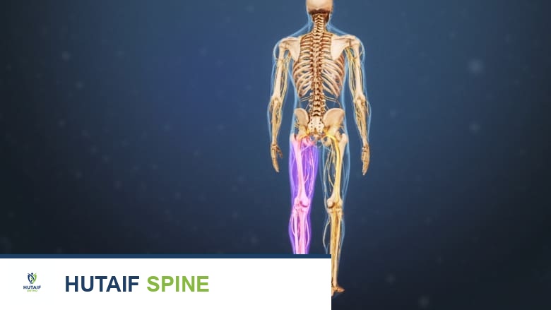 الجنف التنكسي: الأعراض والتشخيص وخيارات العلاج الشاملة مع الدكتور محمد هطيف