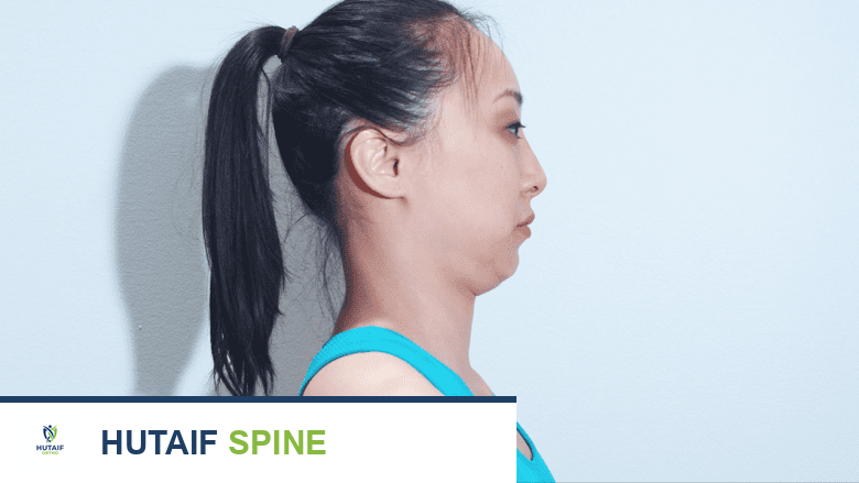 صورة توضيحية لـ تغيير نمط الحياة لعلاج تصلب الرقبة المزمن: دليل شامل من الأستاذ الدكتور محمد هطيف