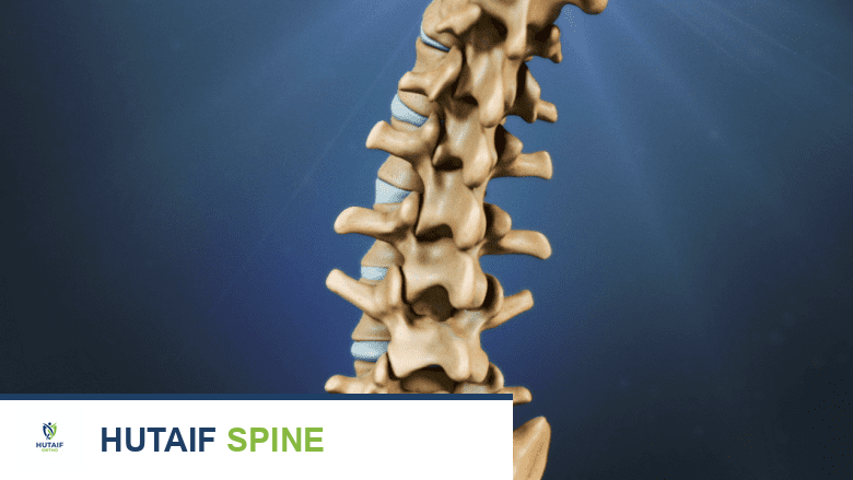 التعافي بعد استئصال القرص المجهري القطني: دليل شامل من الخروج من المستشفى حتى 14 يومًا