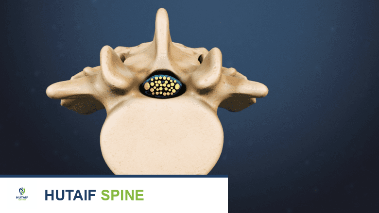 الفقرات القطنية: دليل شامل لصحة عمودك الفقري مع الأستاذ الدكتور محمد هطيف