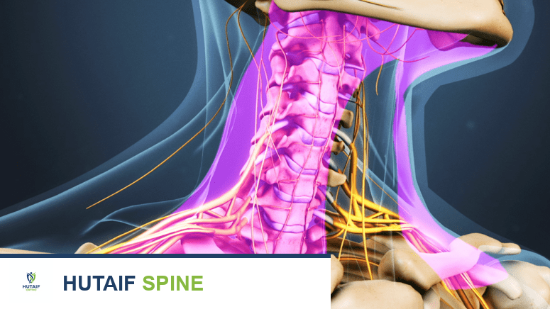 آلام الرقبة: دليلك الشامل للتشخيص والعلاج والوقاية مع الأستاذ الدكتور محمد هطيف