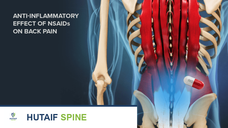 صورة توضيحية لـ التعافي الشامل بعد جراحة دمج الفقرات المتعددة: دليل الأستاذ الدكتور محمد هطيف