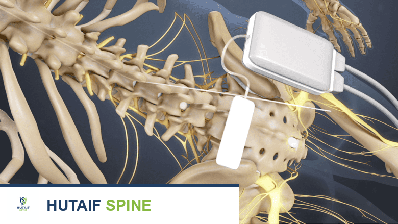 جراحة التهاب المفصل العجزي الحرقفي: دليل شامل للعلاج والتعافي مع الأستاذ الدكتور محمد هطيف