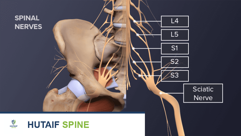 عرق النسا: دليل شامل من الأسباب إلى العلاج والوقاية مع الأستاذ الدكتور محمد هطيف