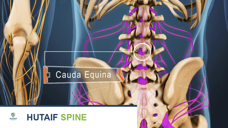 الحبل الشوكي وذيل الفرس في العمود الفقري القطني: دليل شامل للمرضى