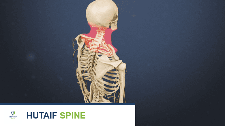 متلازمة كليبل فيل: دليل شامل لفهم الحالة وإدارتها مع الأستاذ الدكتور محمد هطيف