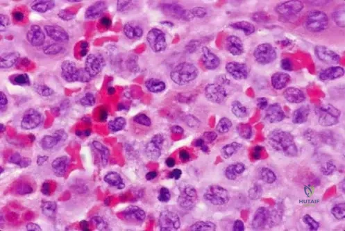 Master ABOS Orthopaedic Review: Bone Tumors, Skeletal Dysplasias & Arthritis Essentials | Part 29