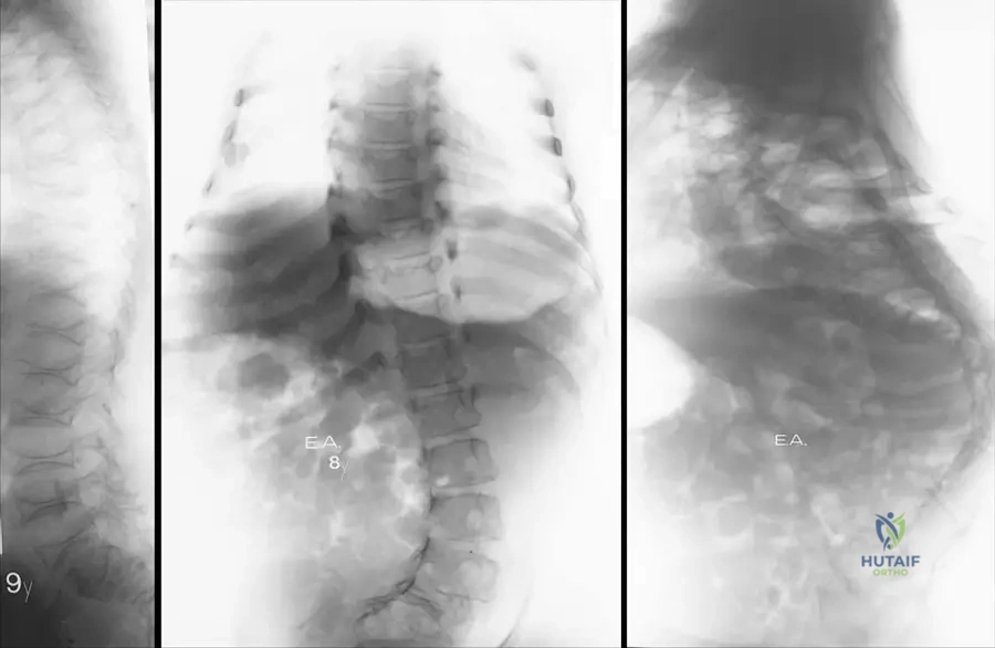 Master ABOS Board Review: Skeletal Dysplasias & Metabolic Bone Diseases | Part 2