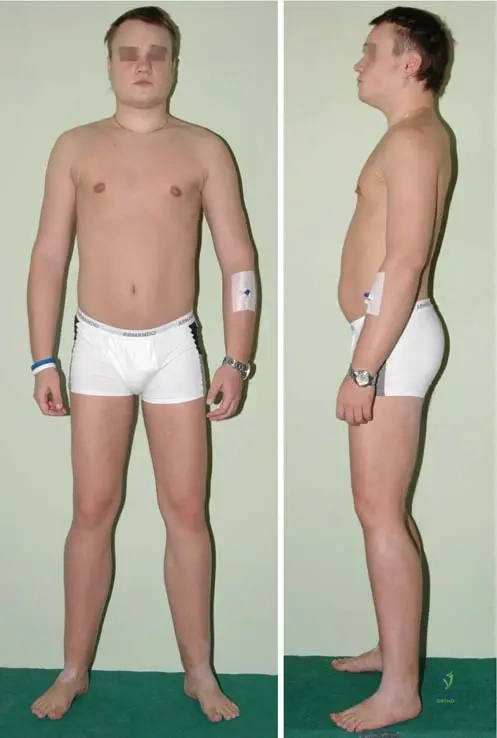 Master ABOS Orthopedic Board Review: Musculoskeletal Pathology & Bone Disorders | Part 12