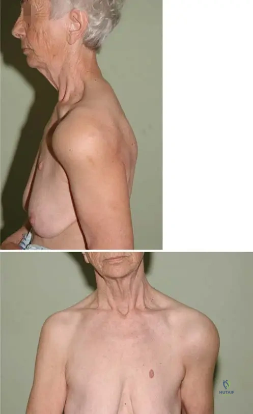 Orthopedic & Rheumatology Board Review: JIA, Bone Tumors, Syringomyelia Cases | Part 8