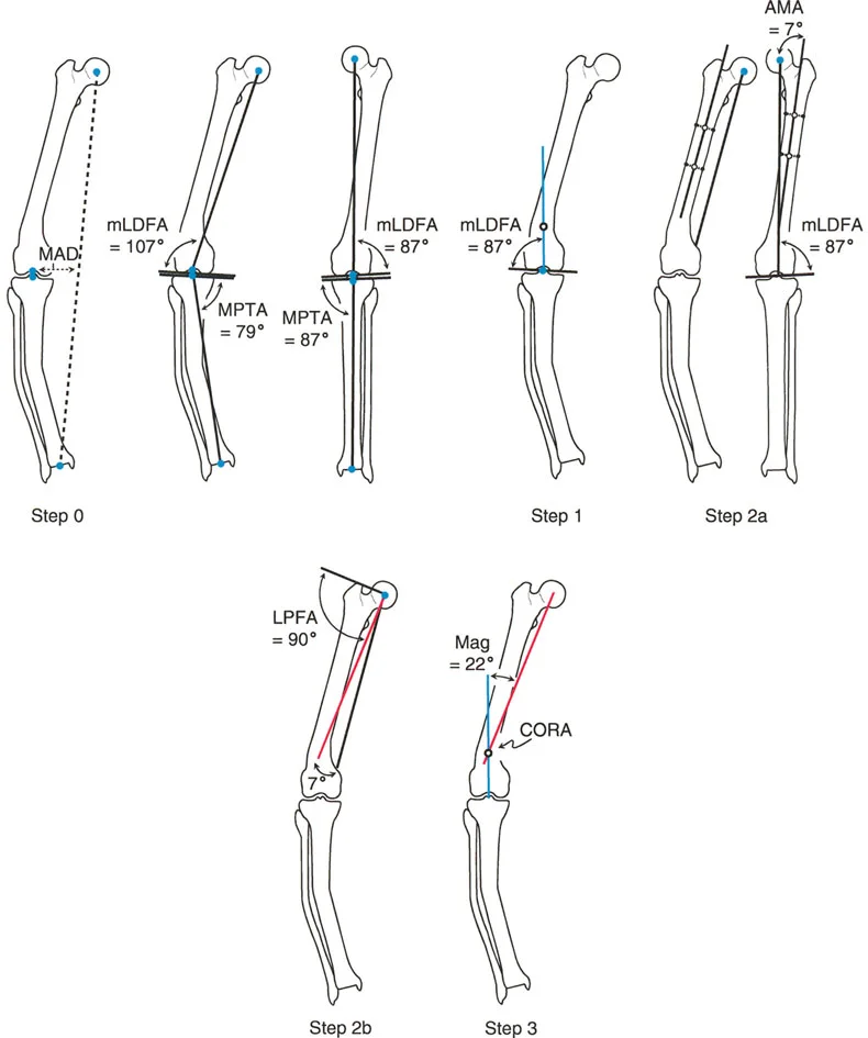 صورة بالأشعة السينية توضح خط المنصف للتشوه