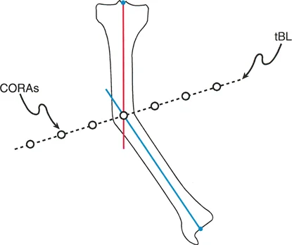صورة توضيحية لـ تخطيط محاور العظام في المستوى الأمامي: دليل شامل لتصحيح تشوهات الأطراف مع الأستاذ الدكتور محمد هطيف