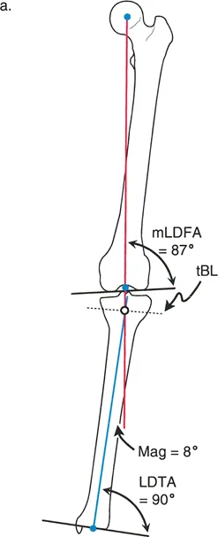 إتقان قطع العظم القبة لتقويم تشوهات الأطراف: دليلك الشامل في صنعاء مع الأستاذ الدكتور محمد هطيف