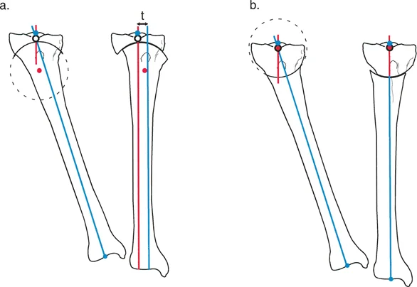 قطع العظم القبة يسمح بتعديل دقيق مع الحفاظ على التلامس