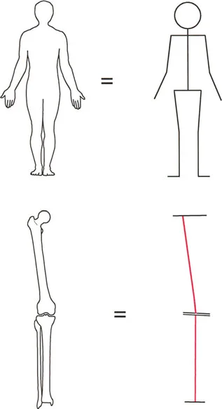 تبسيط الشكل البشري: أساس تحليل التشوه يعتمد على تبسيط الهياكل التشريحية المعقدة إلى خطوط ومحاور ميكانيكية لقياس الانحرافات بدقة.