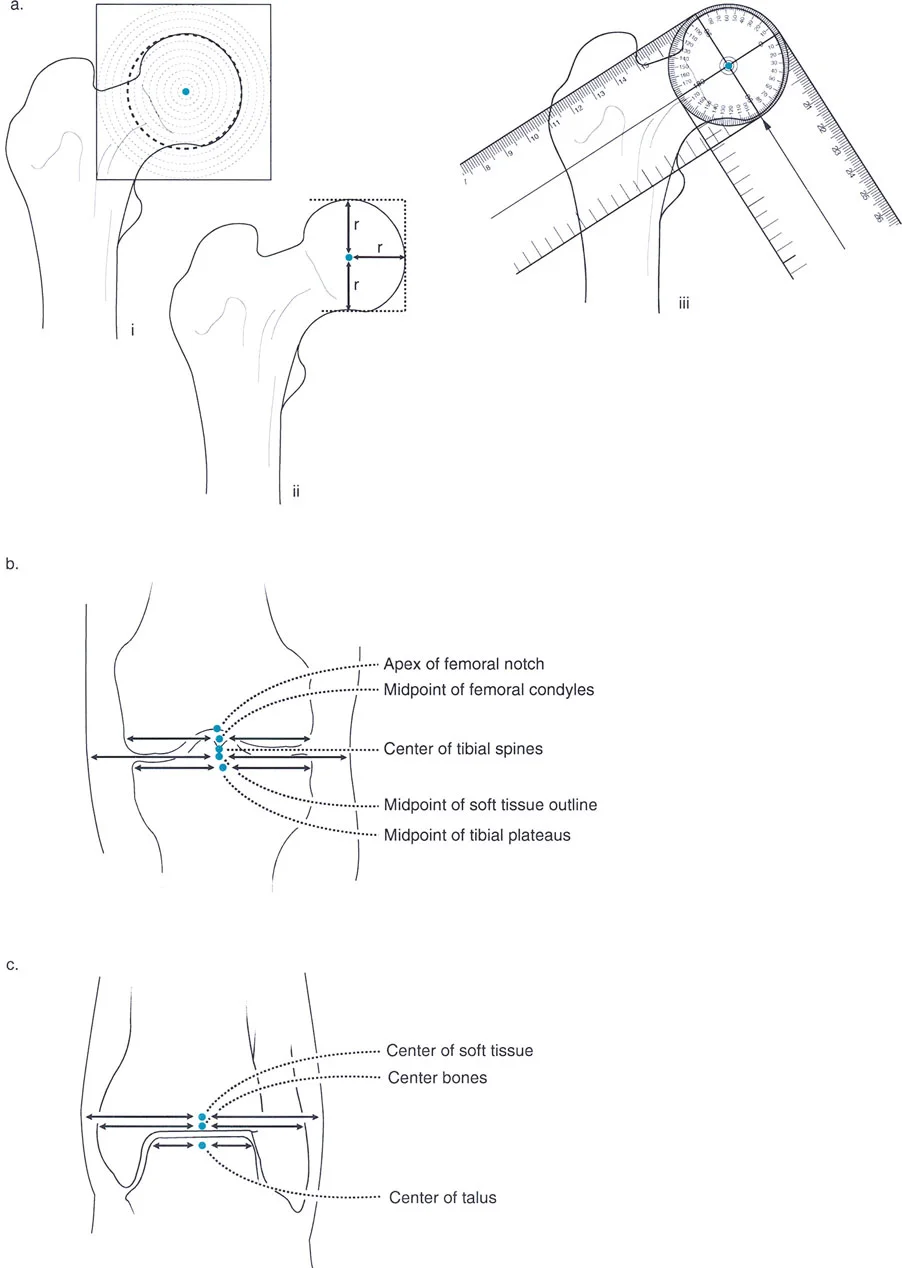 معالم إشعاعية دقيقة لتحديد مركز دوران الورك، خط مفصل الركبة، ومركز الكاحل.