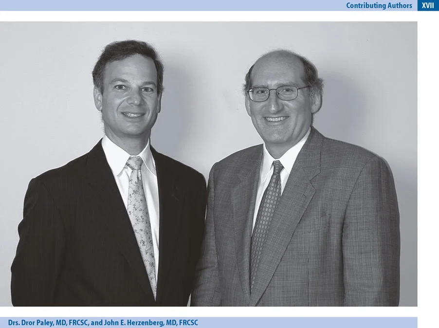 تصحيح تشوهات العظام والساقين: مبادئ بالي ودور الأستاذ الدكتور محمد هطيف في صنعاء