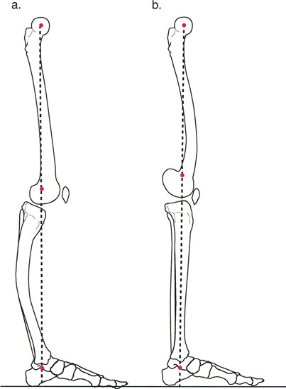 صورة توضيحية للمحور الميكانيكي في المستوى السهمي وعلاقته بمركز دوران الركبة
