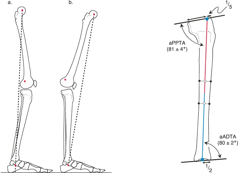 صورة توضيحية لـ الأستاذ الدكتور محمد هطيف: دليل شامل لتشوهات الركبة السهمية (التقوس الأمامي والخلفي) في صنعاء