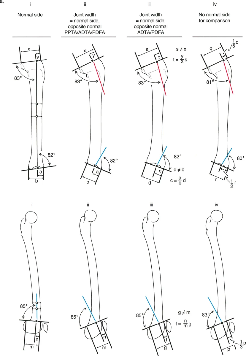 طريقة تحديد نقطة مرجع حافة المفصل (JER) في المستوى السهمي لرسم نقاط البداية والنهاية لاختبار سوء التوجه (MOT) في سيناريوهات سريرية مختلفة. (1) الجانب الطبيعي. (2) عرض المفصل المقابل هو نفسه. (3) عرض المفصل المقابل مختلف. (4) لا يوجد جانب طبيعي متاح للمقارنة.
