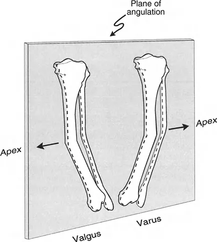 صورة توضيحية لاتجاهات ذروة التشوه في المستويات التشريحية