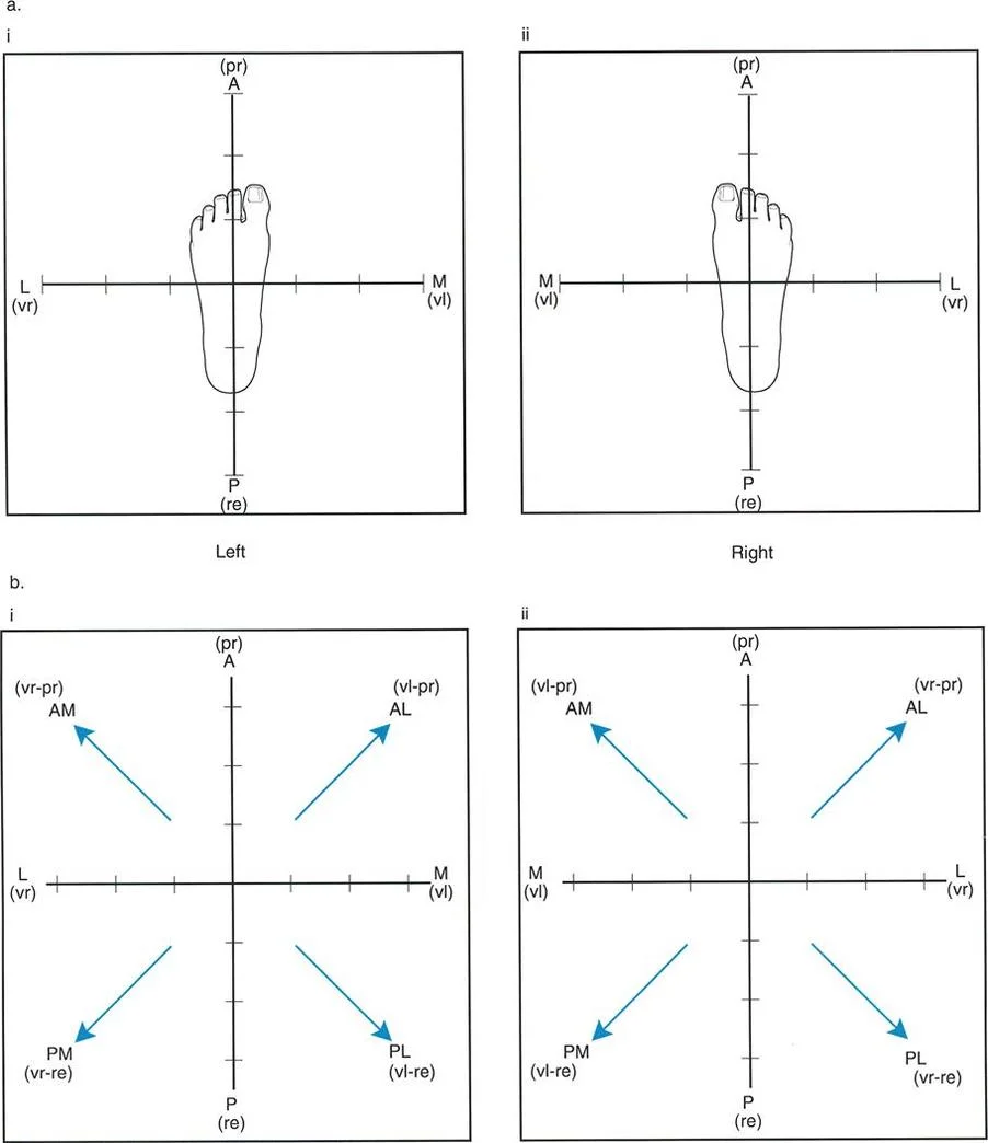 صورة توضيحية للاتجاهات الرباعية للتشوهات المائلة