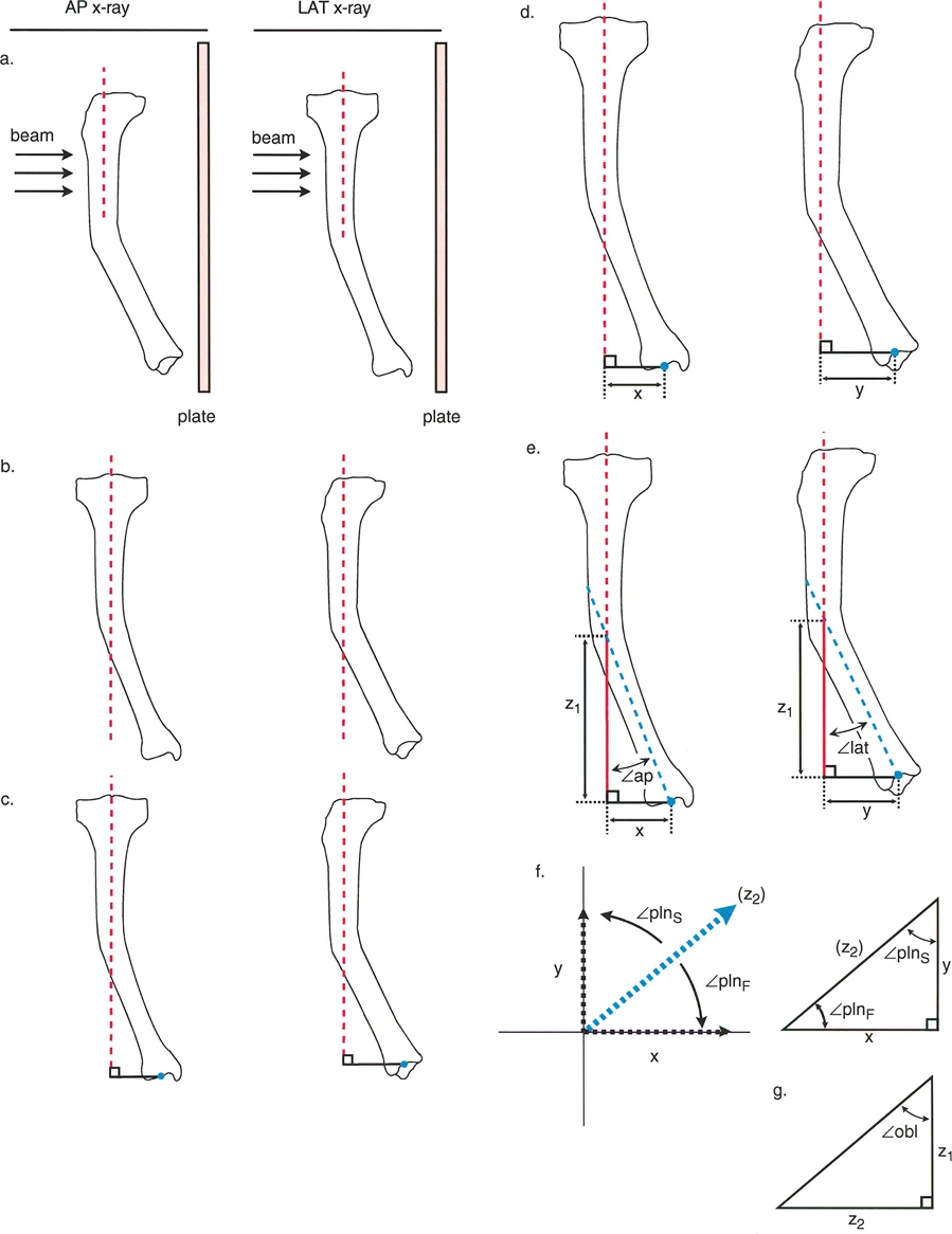 صورة توضيحية للخطوة الأولى من طريقة قاعدة المثلث