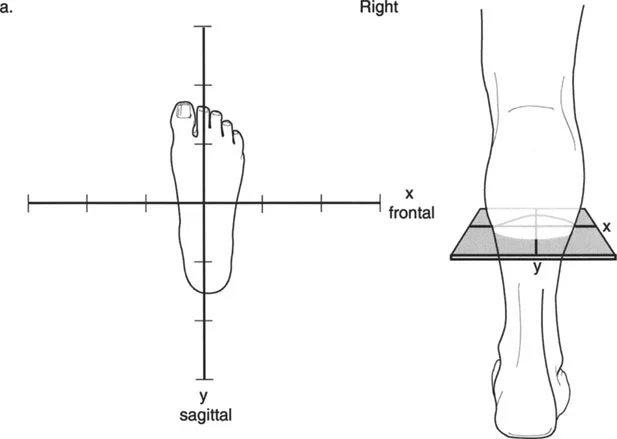 صورة توضيحية للرسم البياني المتعامد لطريقة بالي
